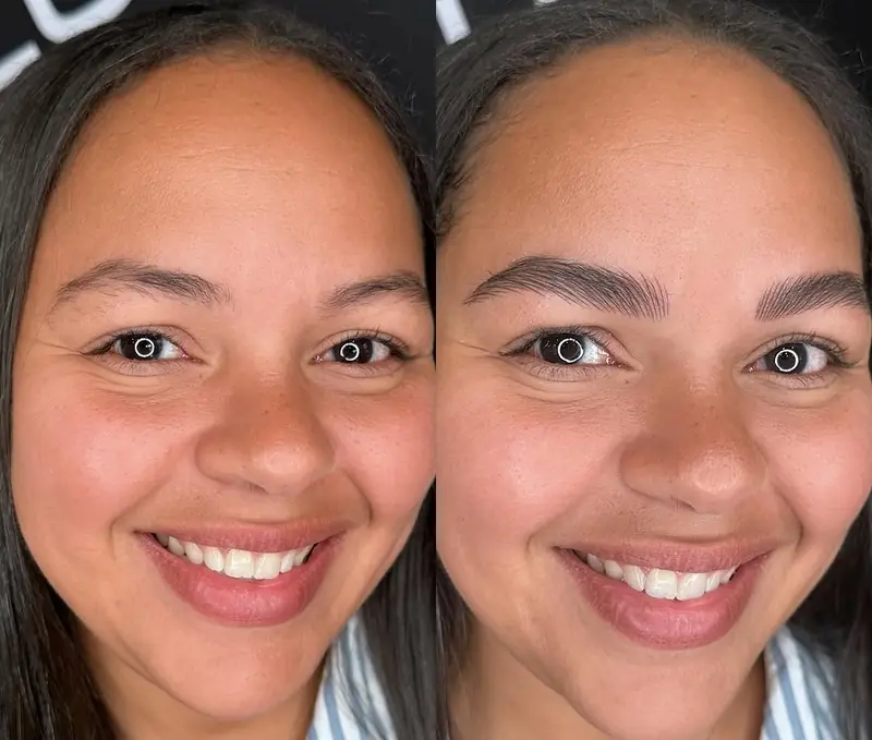 Natural results that last ⭐