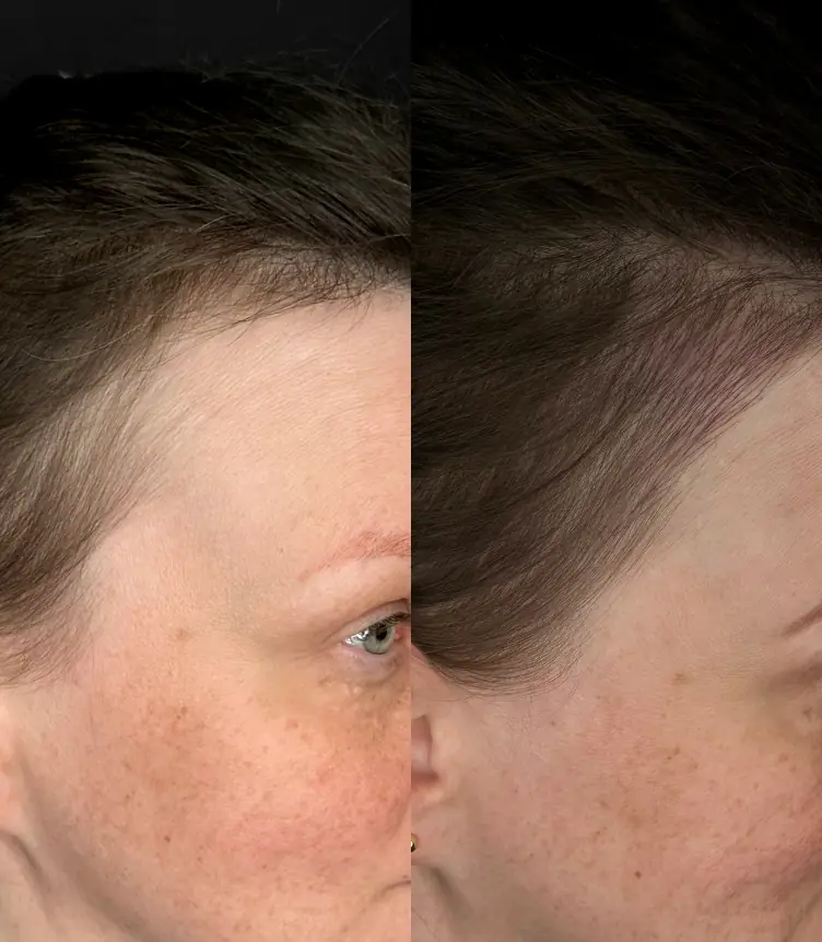 NanoHair